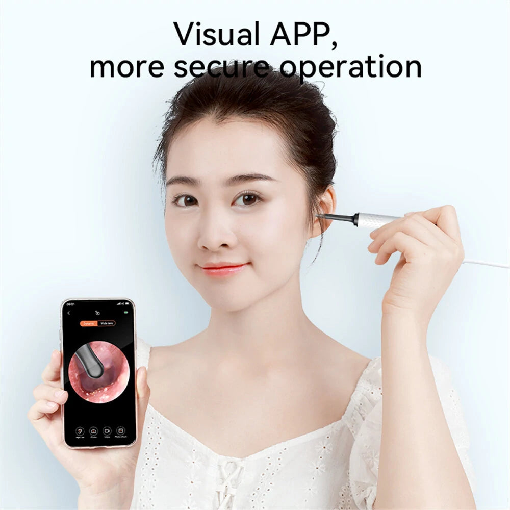 5MP HD Camera Ear Cleaning Endoscope with 360° Precision & Wi-Fi