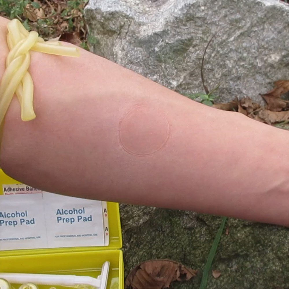 Snake Bite and Sting Suction Extractor Pump